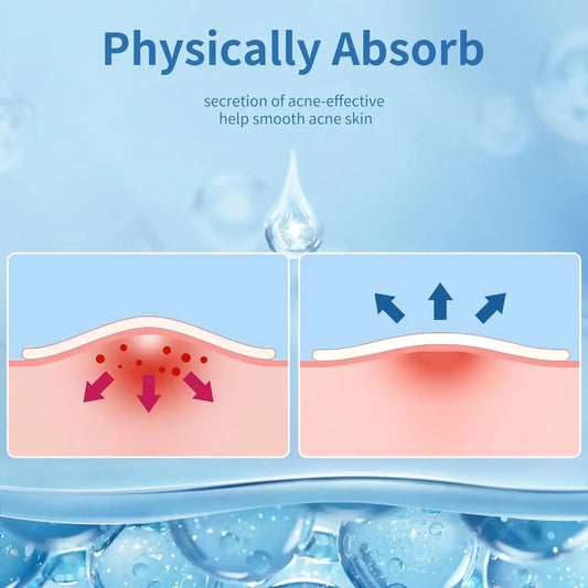 Hydrocolloid Acne Stickers Daily Skincare